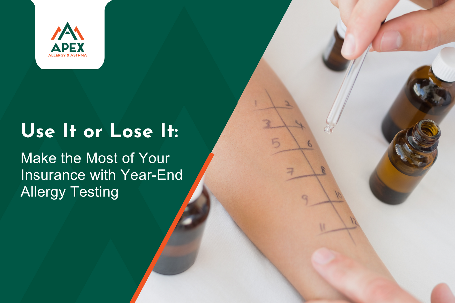 Make The Most Of Your Insurance With Year End Allergy Testing