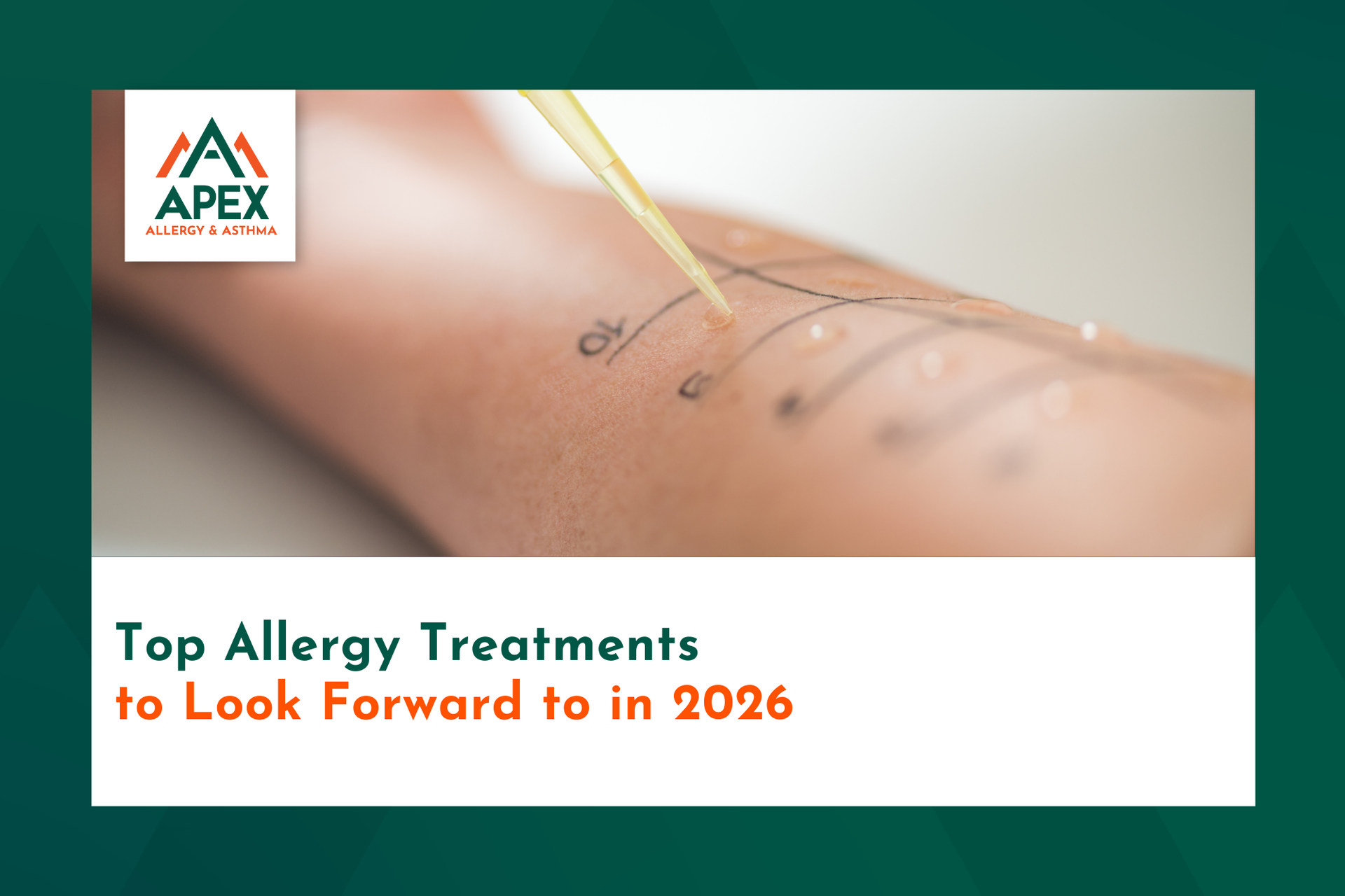 A patient is waiting patiently while getting allergy testing in San Antonio.