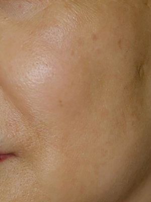 A close up of a woman 's face with no makeup on.
