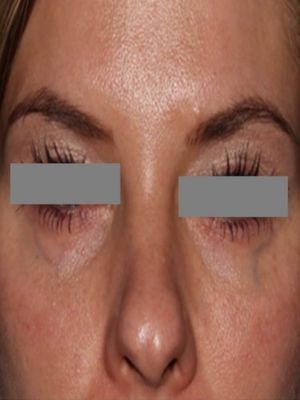 A close up of a woman 's face with her eyes closed.