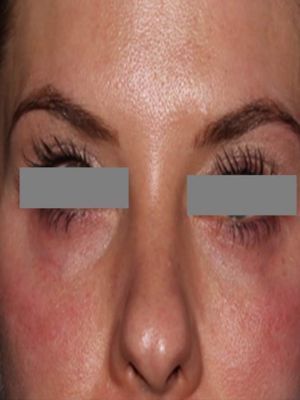 A close up of a woman 's face with her eyes closed