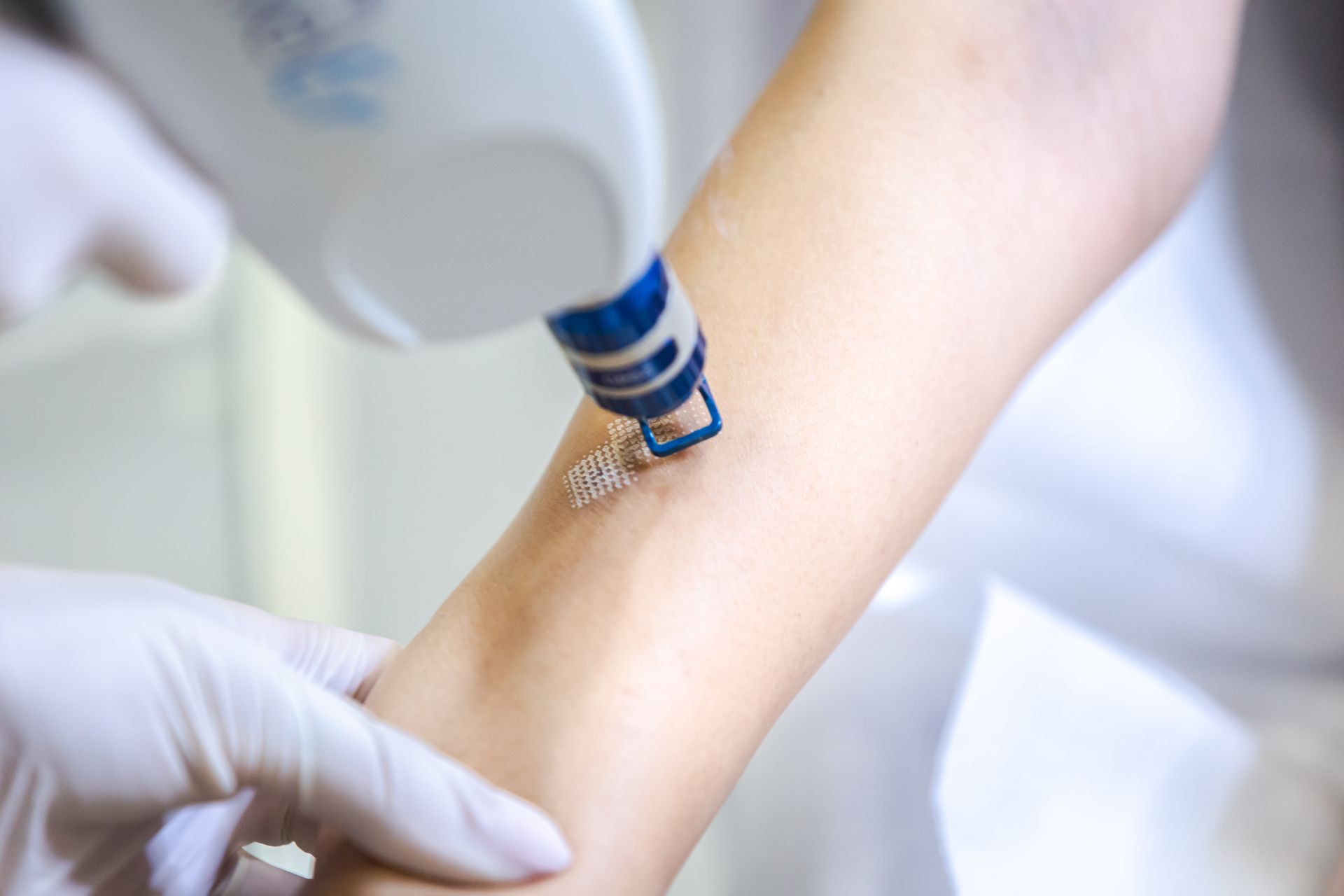 A person is getting a laser treatment on their arm.