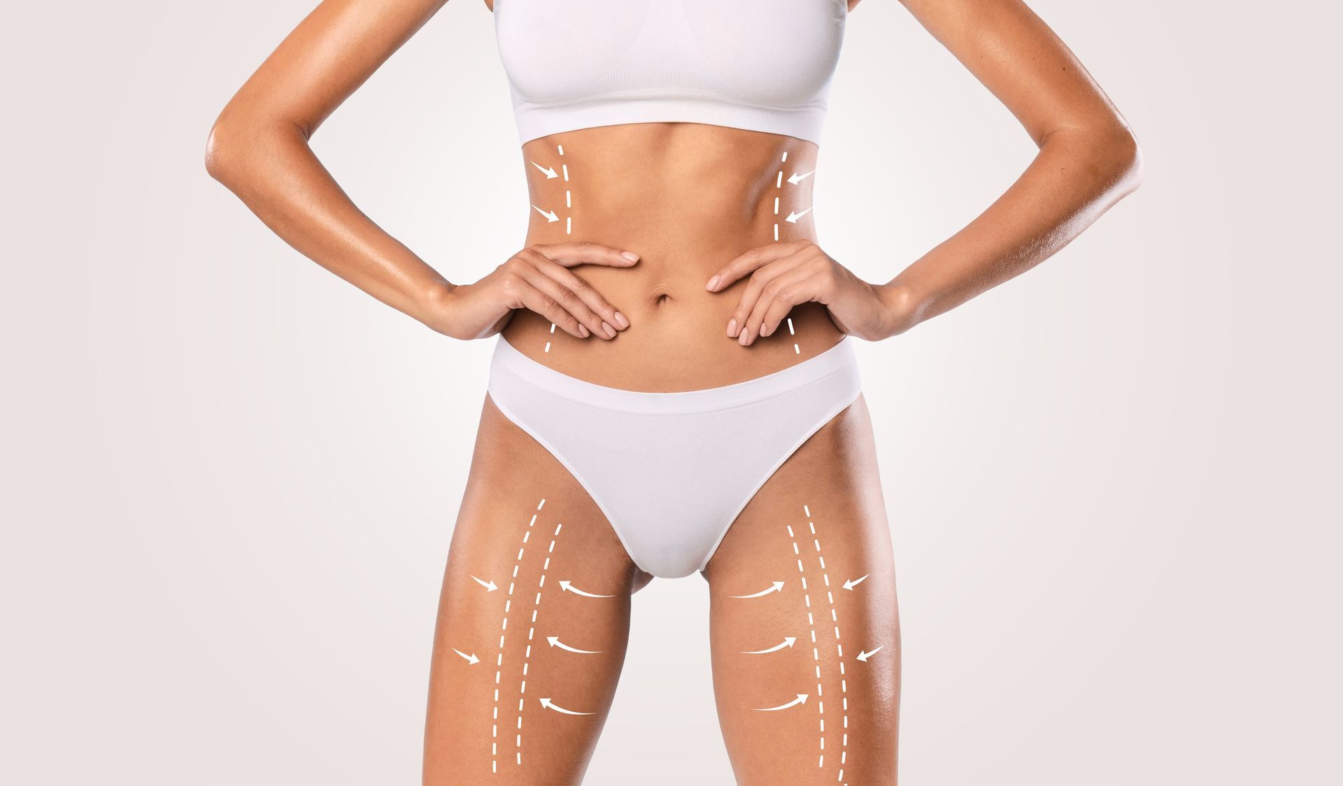 A woman in white underwear is standing with her hands on her hips and has lines drawn on her body.