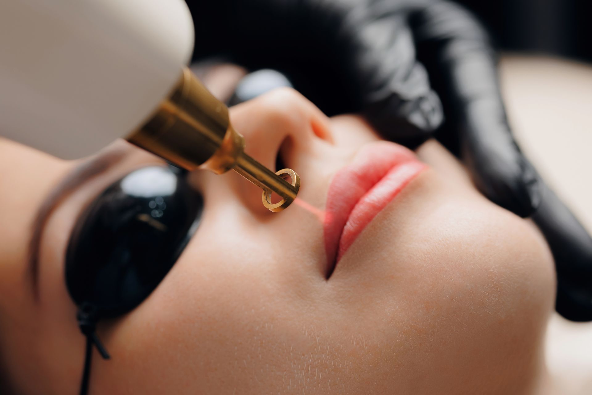 A woman is getting a laser treatment on her face.