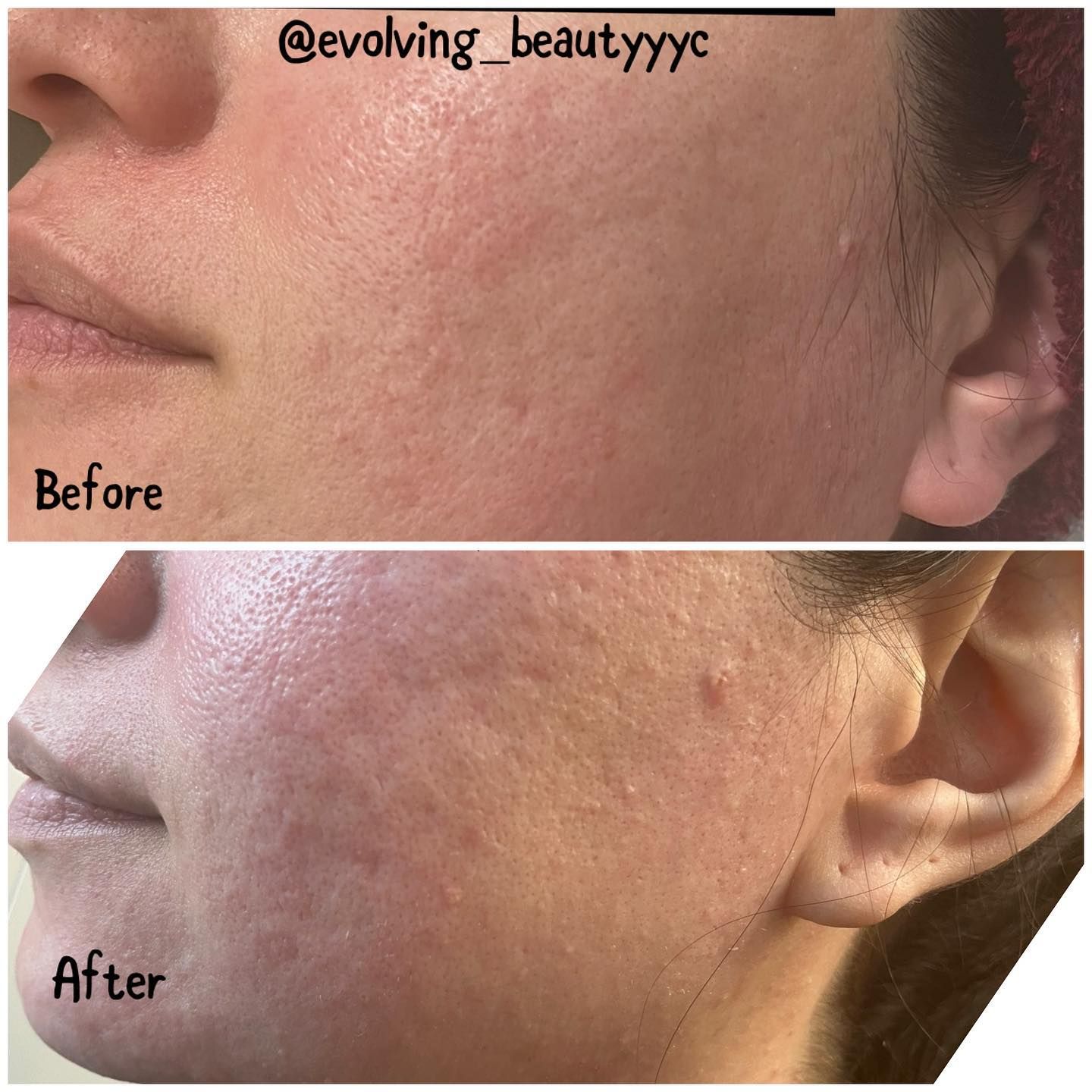 A before and after photo of a woman 's face