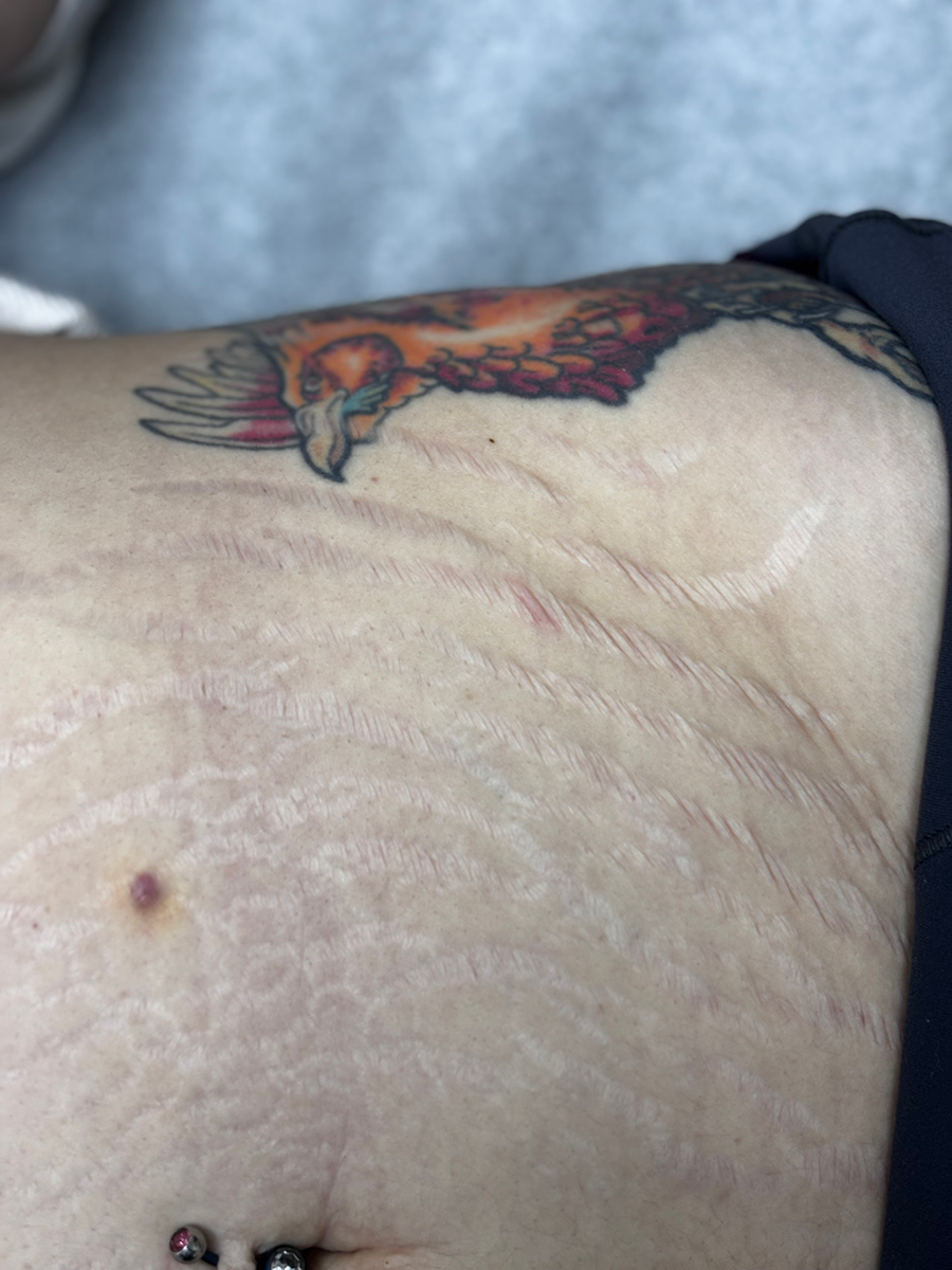 A close up of a person 's stomach with a tattoo on it.