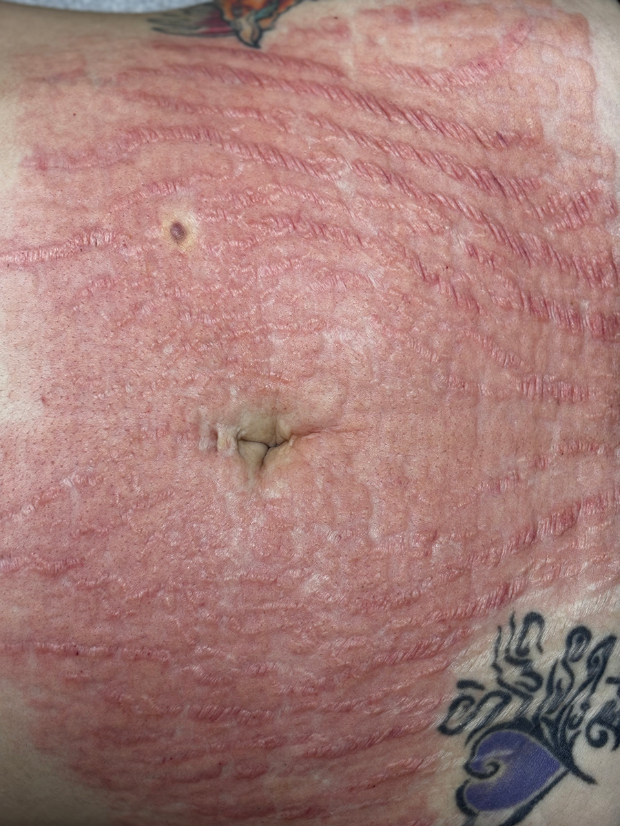 A close up of a woman 's stomach with a tattoo on it.