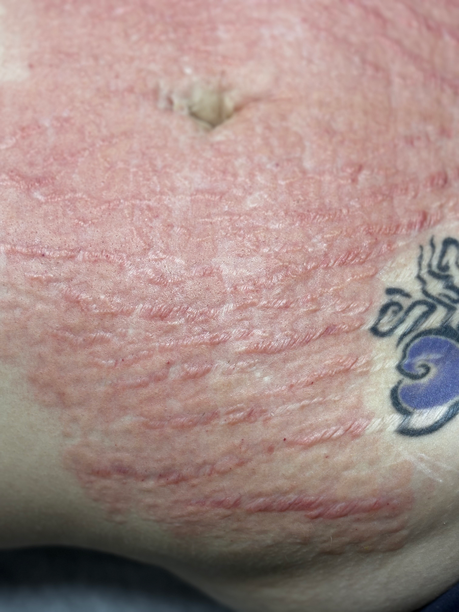 A close up of a person 's stomach with a tattoo on it.