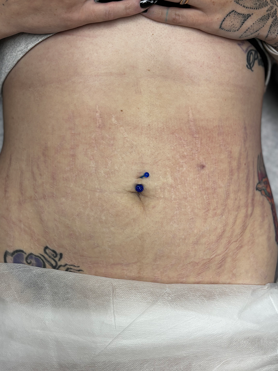 A close up of a woman 's stomach with a belly button piercing.
