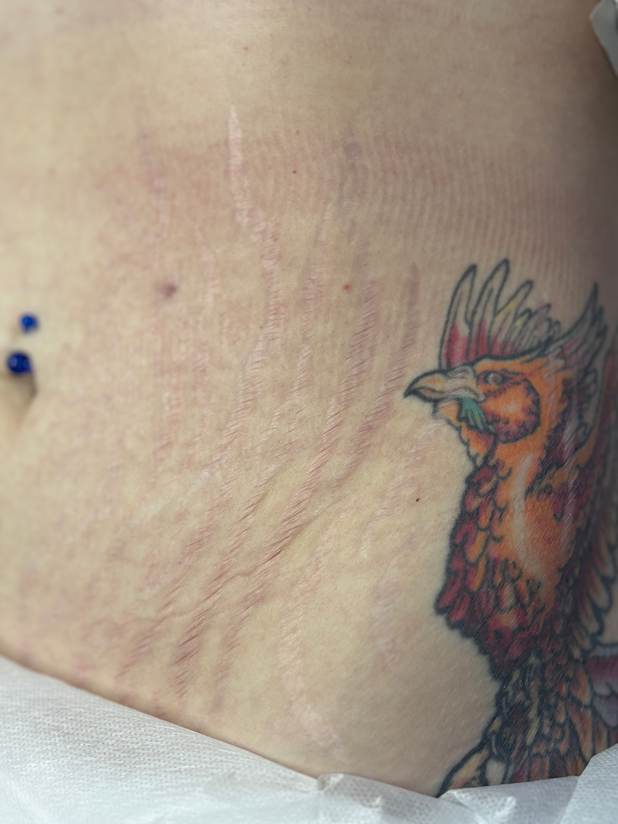 A woman has a tattoo of a rooster on her stomach.