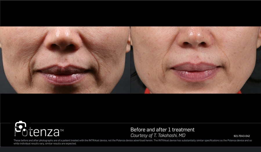 A before and after photo of a woman 's face