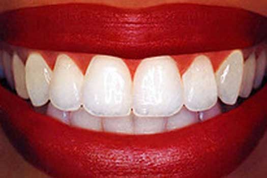 DRA. MARISELA MONARREZ SALDÍVAR - periodoncia