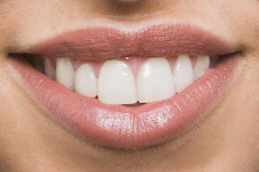 DRA. MARISELA MONARREZ SALDÍVAR - limpieza bucal