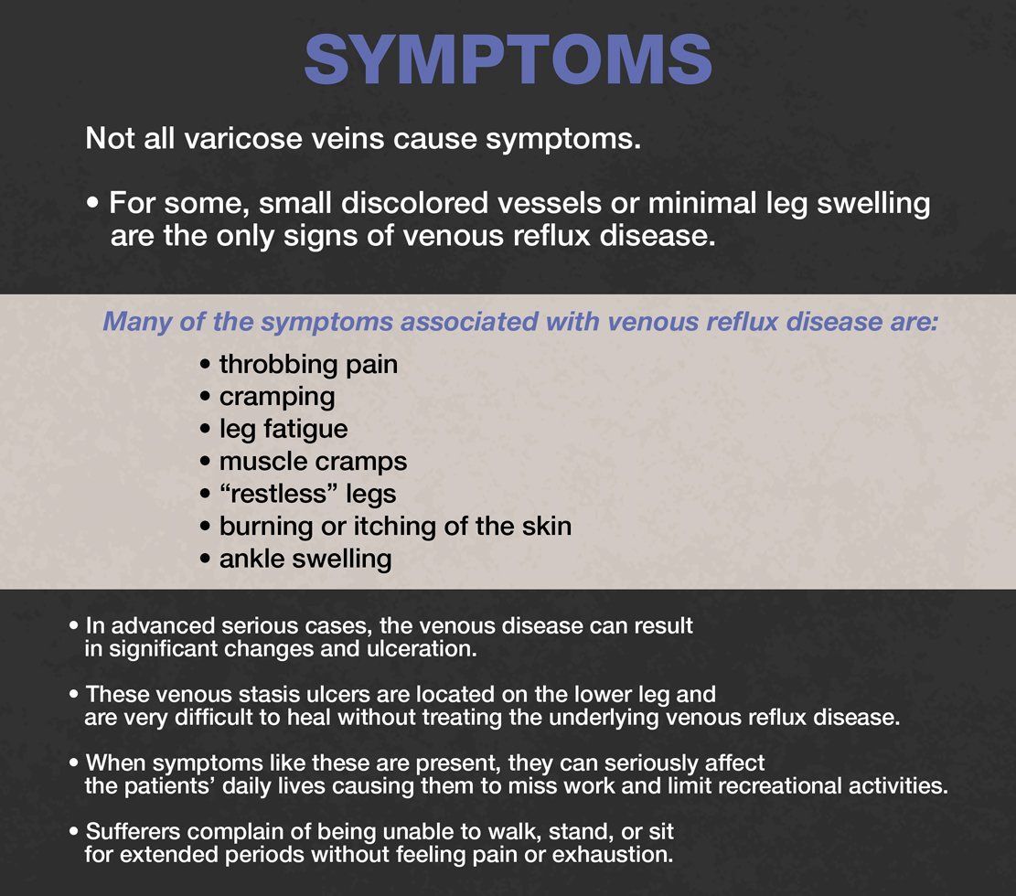 symptoms varicose veins VIRA