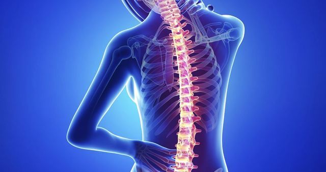 Riabilitazione posturale