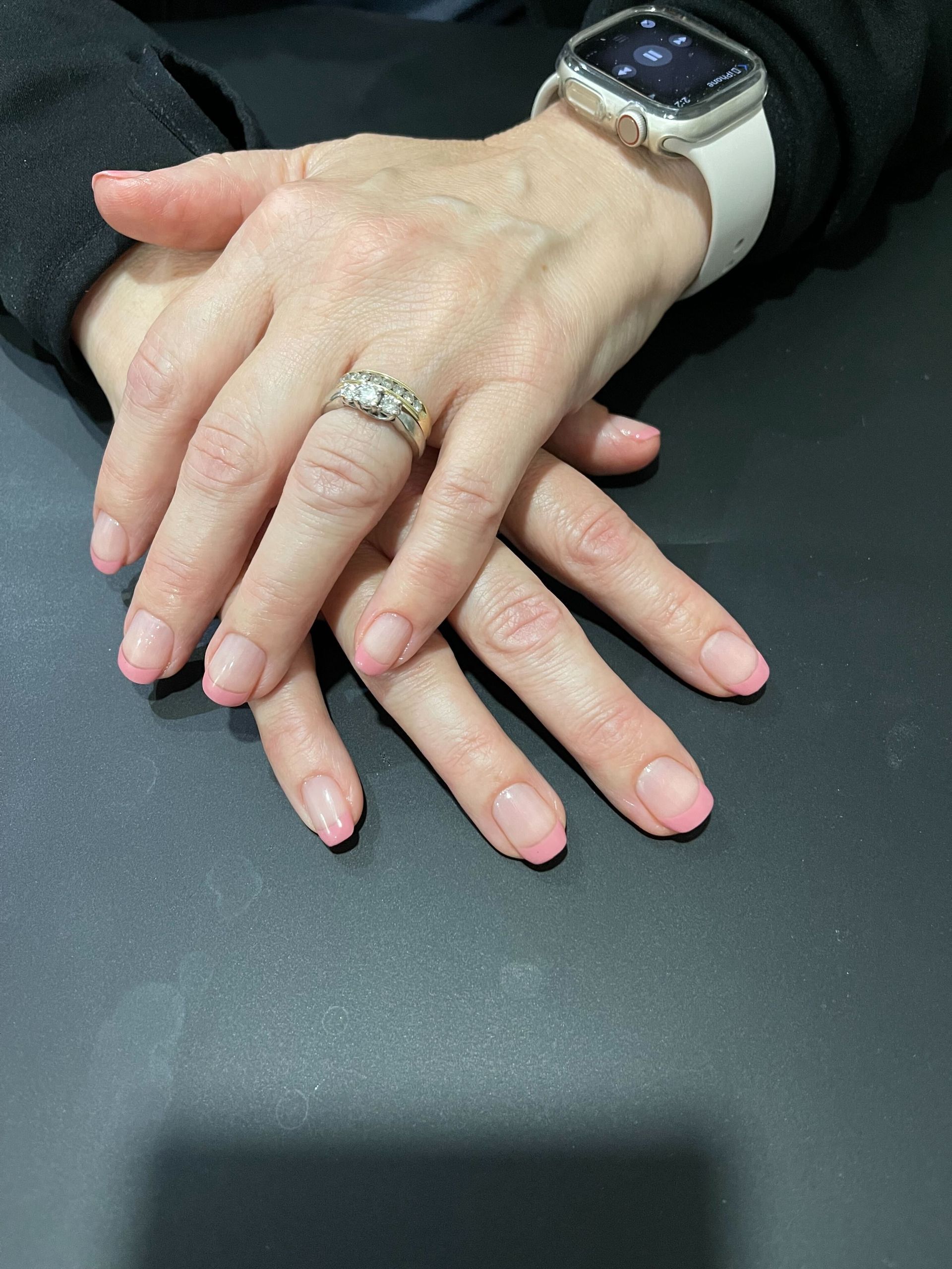 a woman wearing an apple watch and a wedding ring