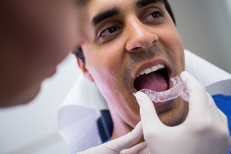 A man is getting an Invisalign aligner placed on his teeth by a dentist.