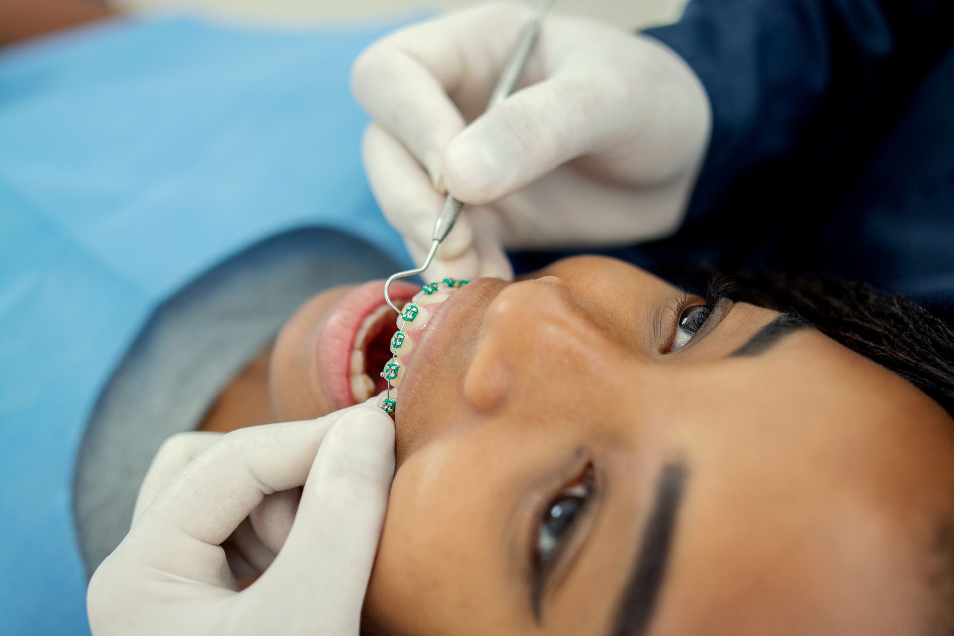Person with braces has dental work done by a gloved dentist. Close-up, blue drape, green brackets.