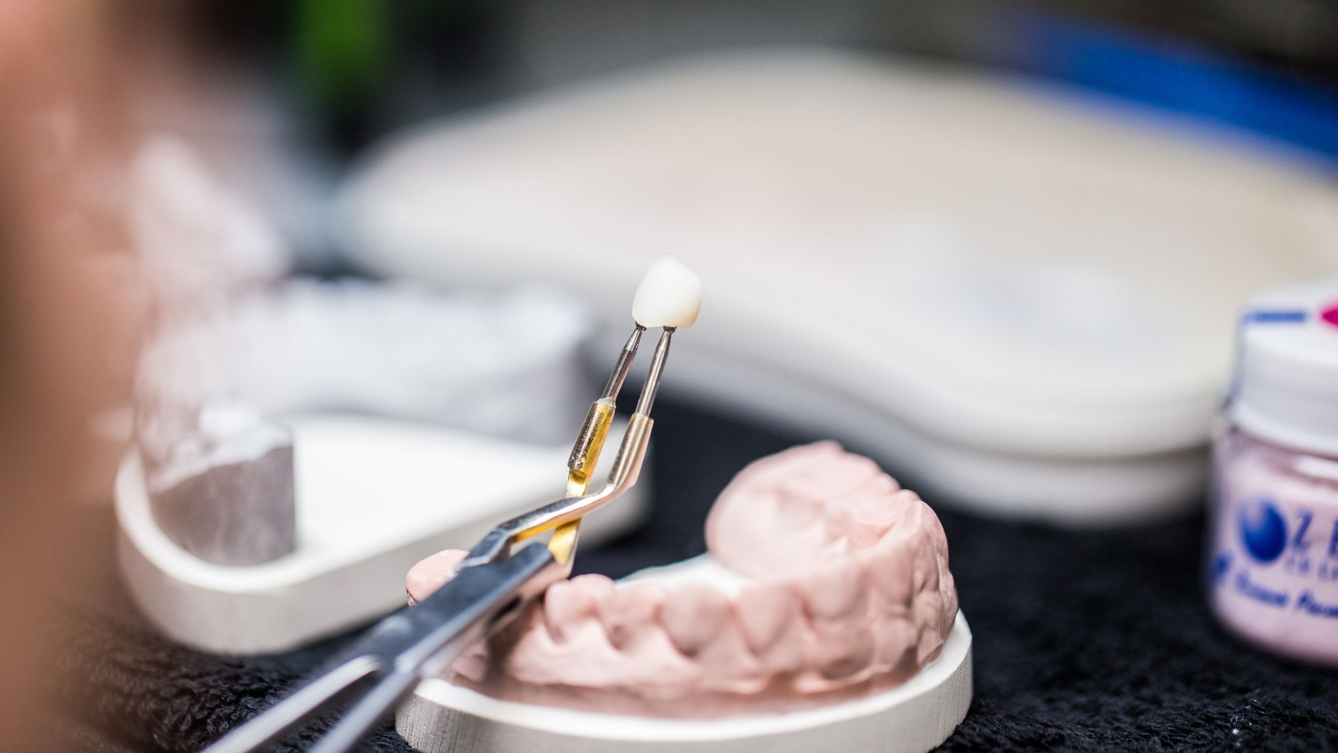 A dental technician holding a tooth crown with forceps over a plaster mold of teeth.