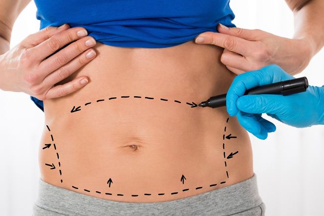 Body Sculpting- Affordable Medical Care in Elmhurst, NY