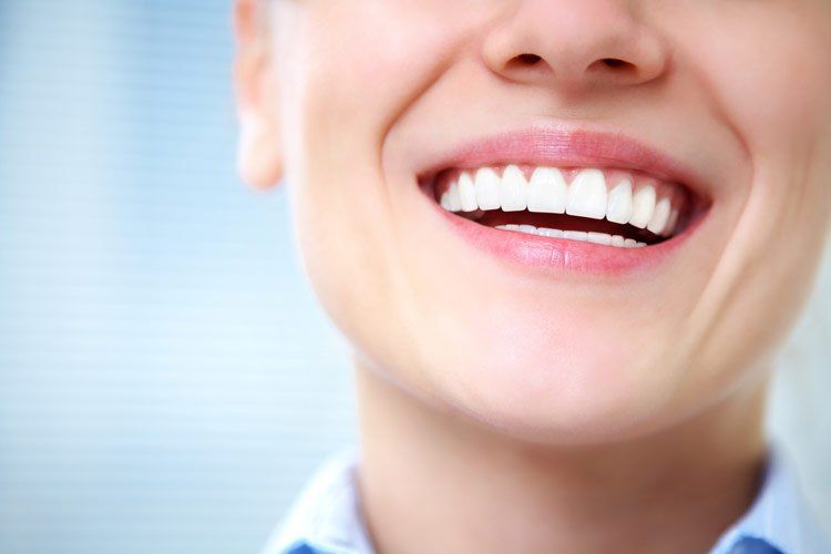 Beautiful Smile with White Teeth — Westlake, OH — Aico’s Dental Group