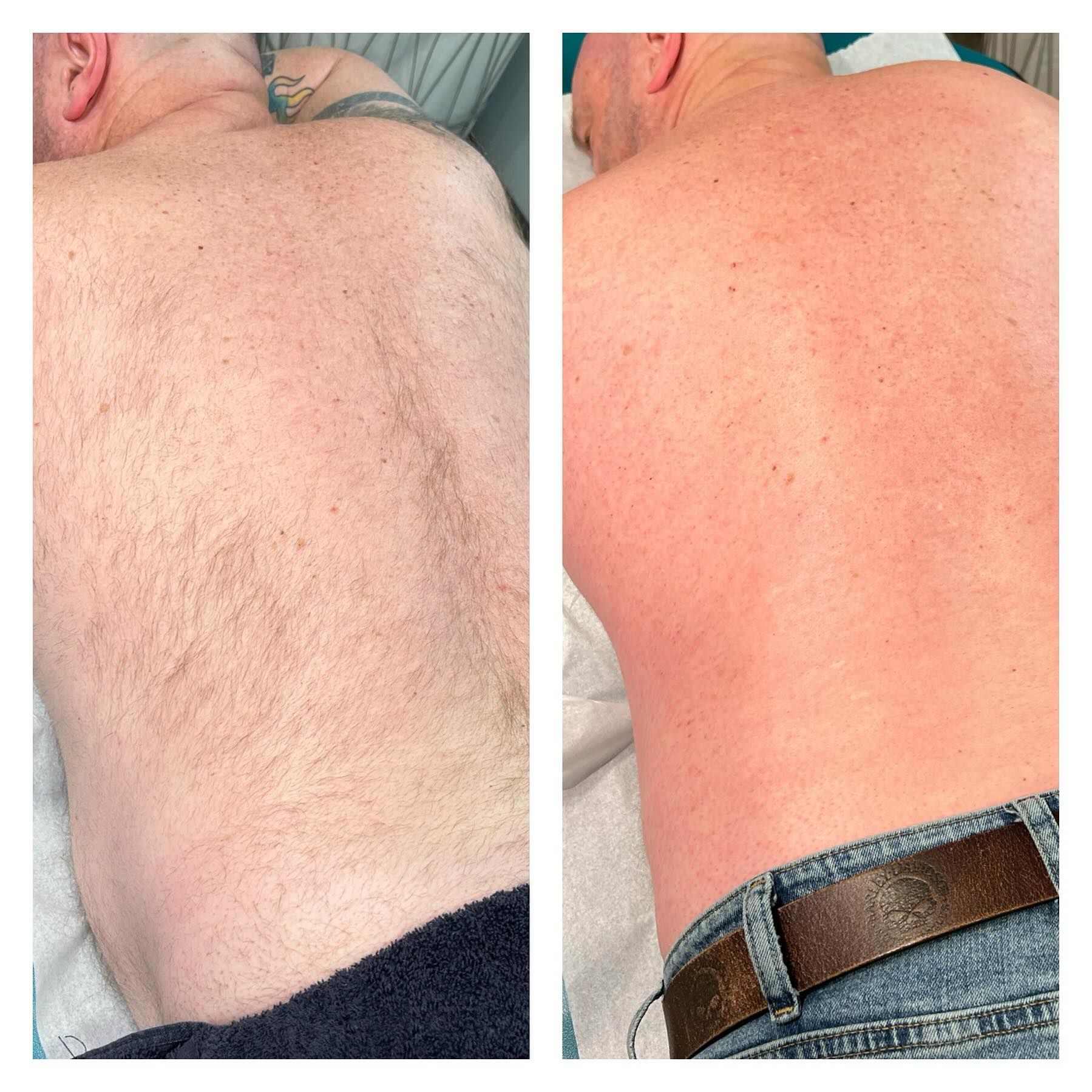 A before and after picture of a man 's back