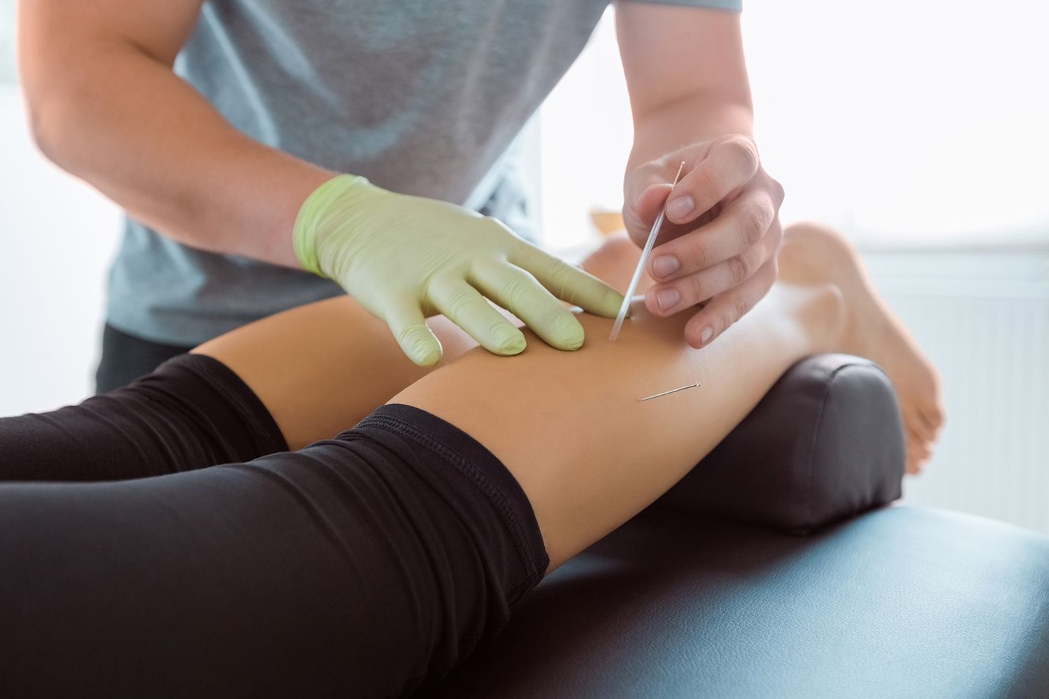 Woman Treated with Acupuncture — Brookline, MA — Shanghai Acupuncture & Herbal Services