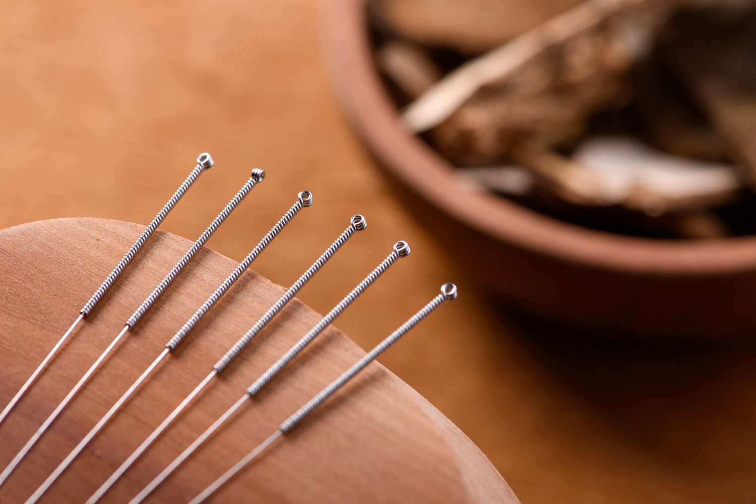 Acupuncture Needle — Brookline, MA — Shanghai Acupuncture & Herbal Services