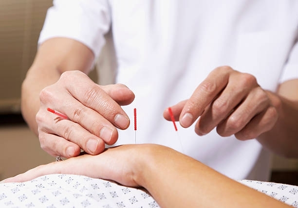 Acupuncture Expert — Brookline, MA — Shanghai Acupuncture & Herbal Services