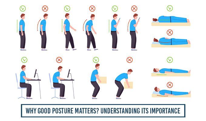 Understanding Posture: What It Is, Types, Causes, and How to Improve It