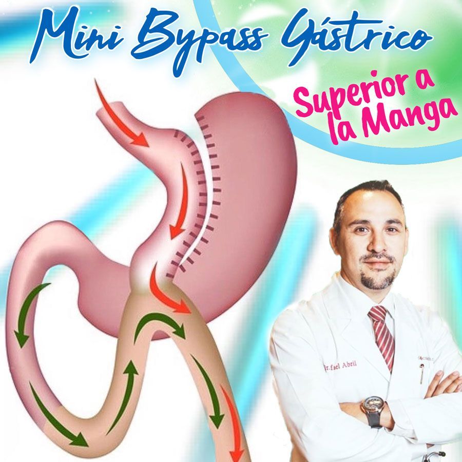 ABRIL ANDARA RAFAEL DR.- Mini Bypass