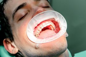 Ragazza durante una visita dal dentista