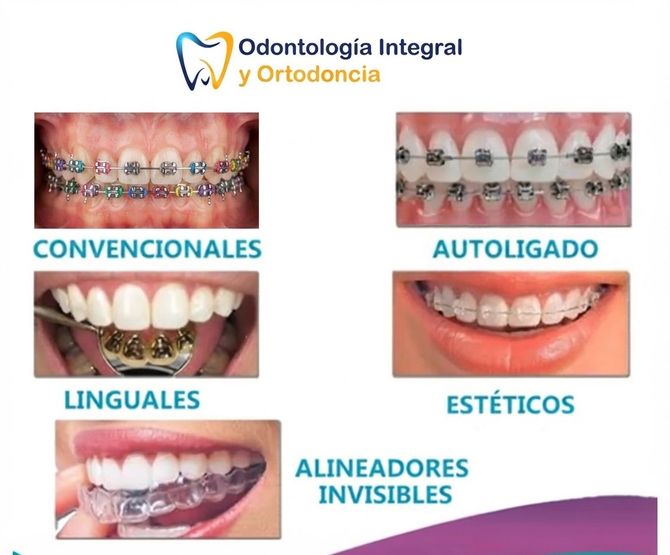 ODONTOLOGÍA INTEGRAL Y ORTODONCIA