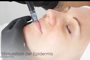 Nahaufnahme einer Frau bei Needling