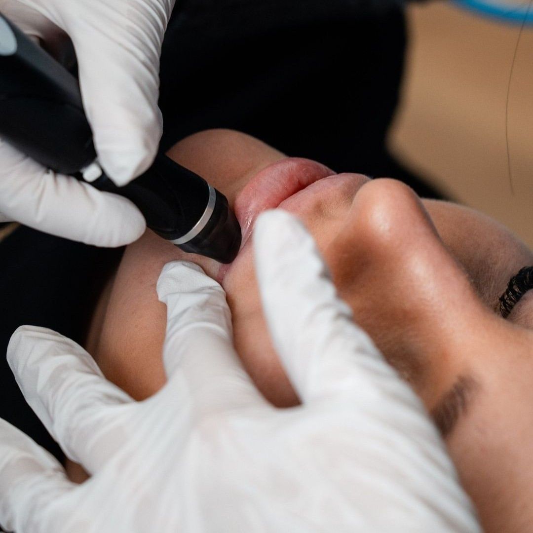 Eine Person mit weißen Handschuhen verwendet ein Gerät im Gesicht einer anderen Person bei einer Hydrafacial Behandlung.