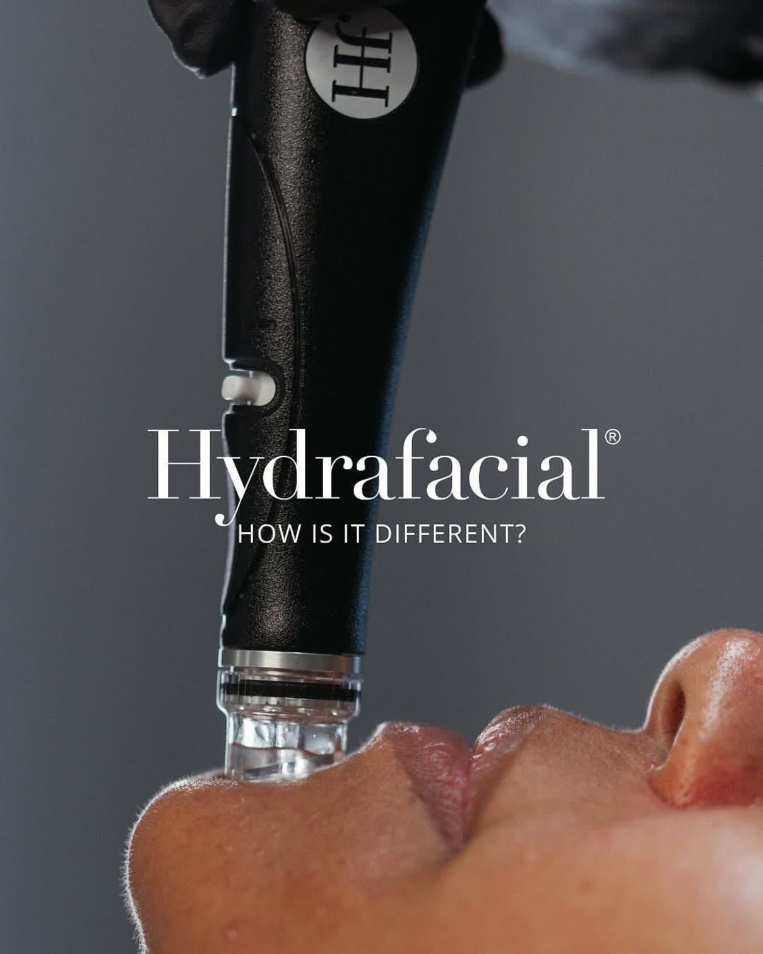 Eine Frau bekommt eine Hydrafacial-Behandlung im Gesicht.