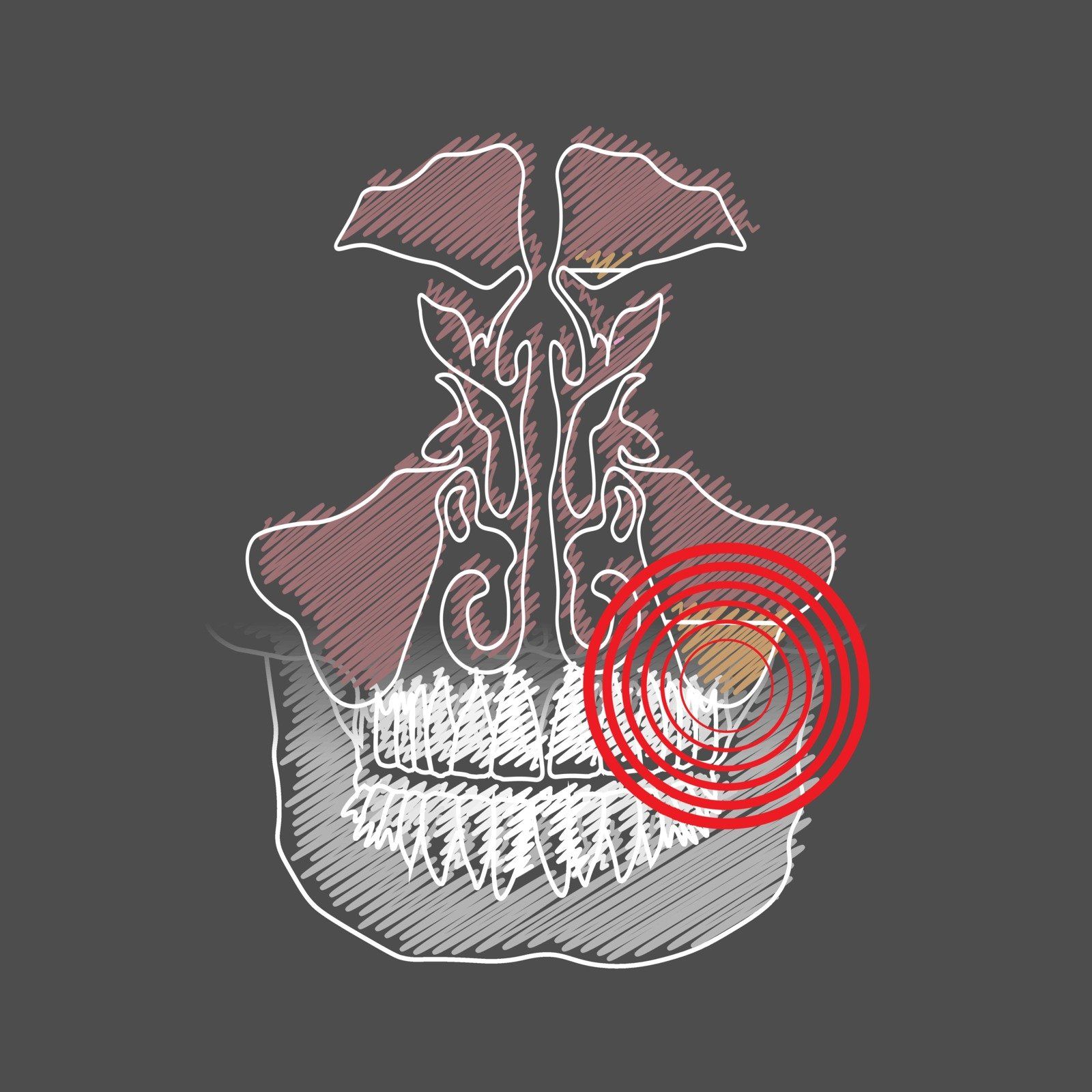 Thyroid Treatment