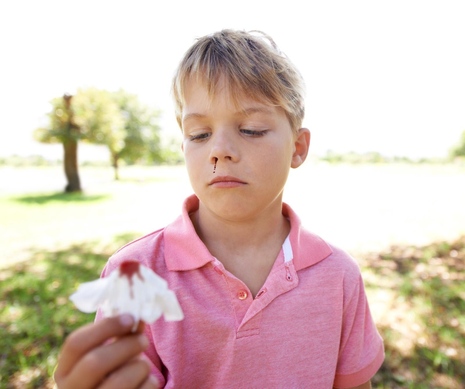 A child managing his bleeding nose.