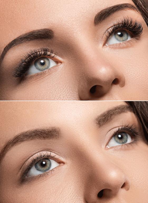Before And After Saline Removal — Evansville, IL — Permanent Makeup & More
