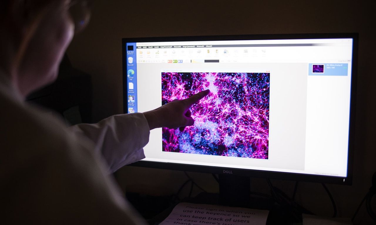 World’s first personalized DNA editing treatment, world record in Philadelphia, Pennsylvania