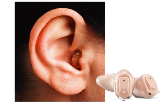 Best Hearing Aid Shop Zirakpur
