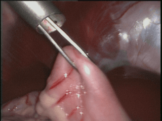 gastropexy profilattica gastropexy profilattica