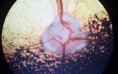 oftalmologia con chirurgia oftalmica