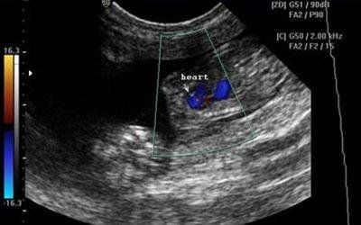Esecuzione ecografia veterinaria