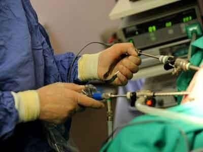chirurgia endoscopica