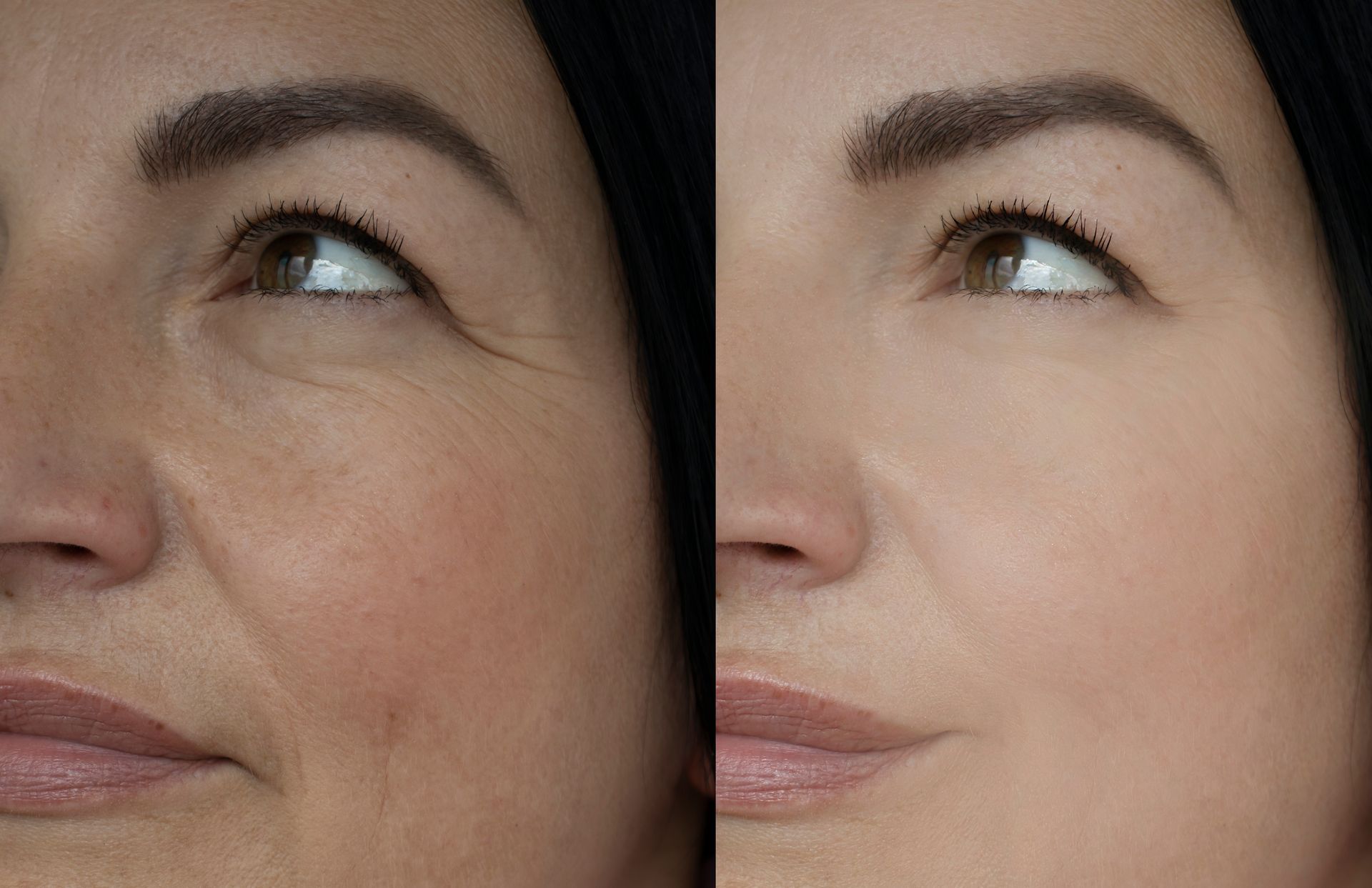 A before and after photo of a woman 's face.