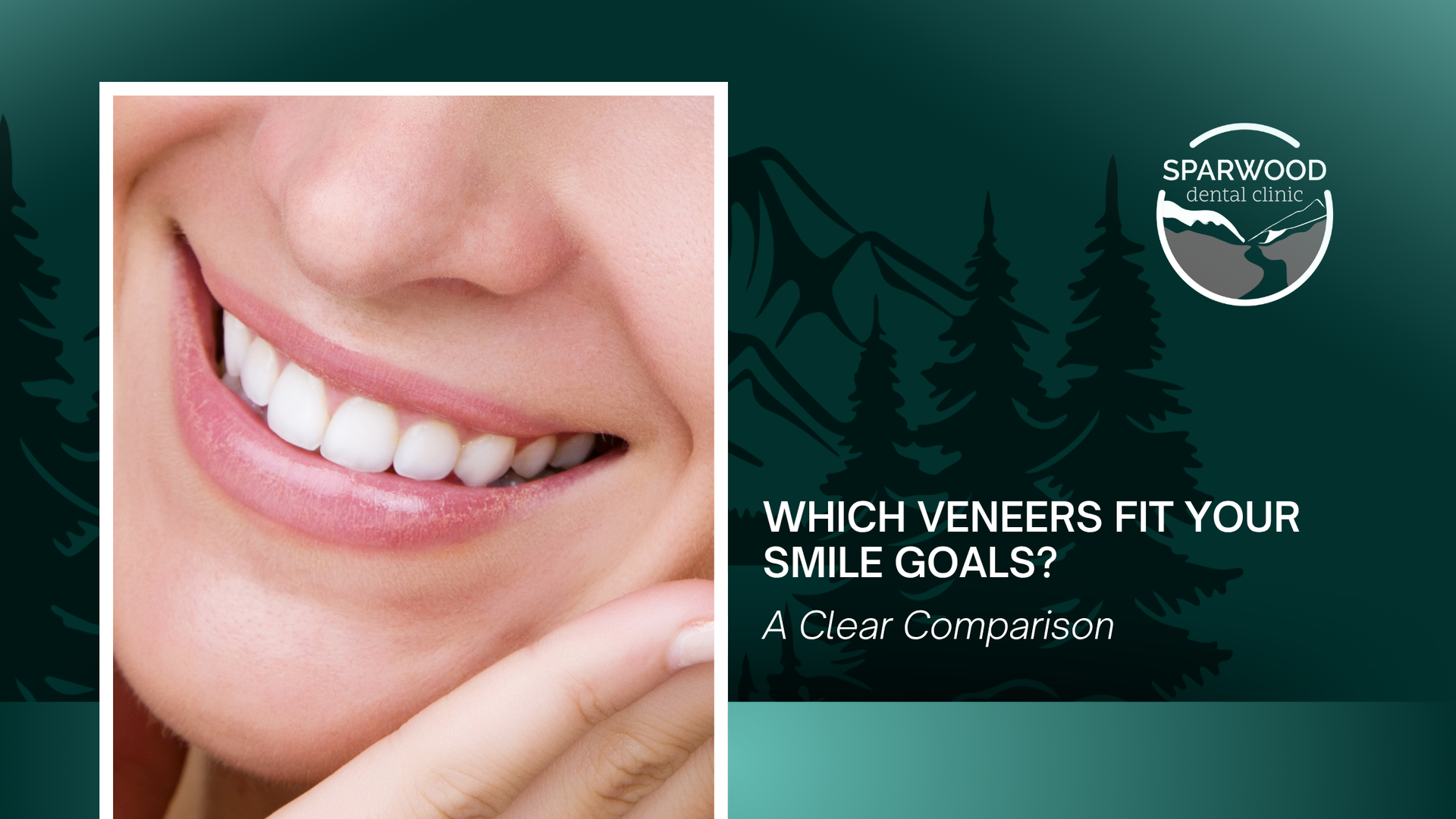 Which veneers fit your smile goals a close comparison