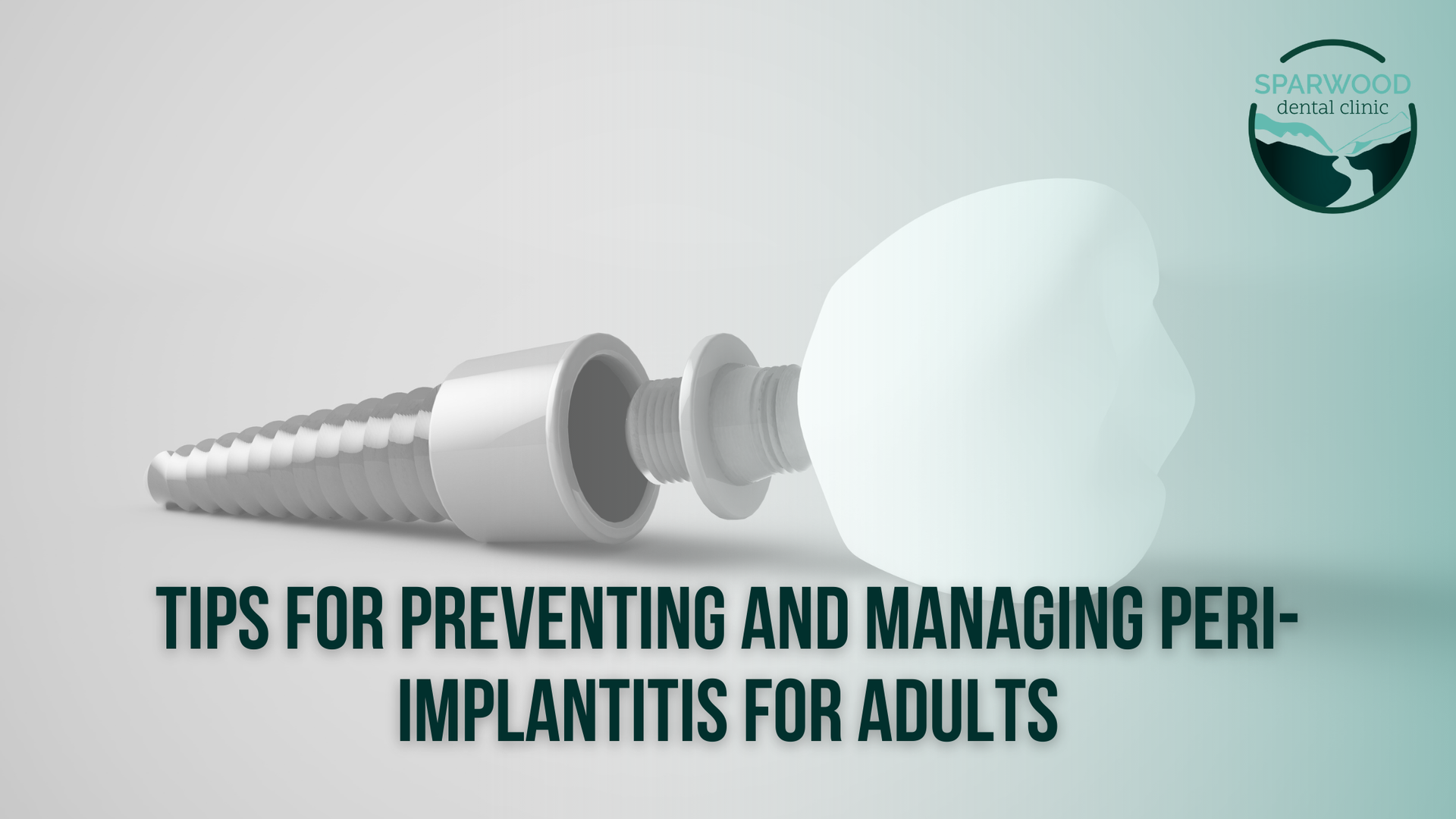 Tips for preventing and managing peri implantitis for adults