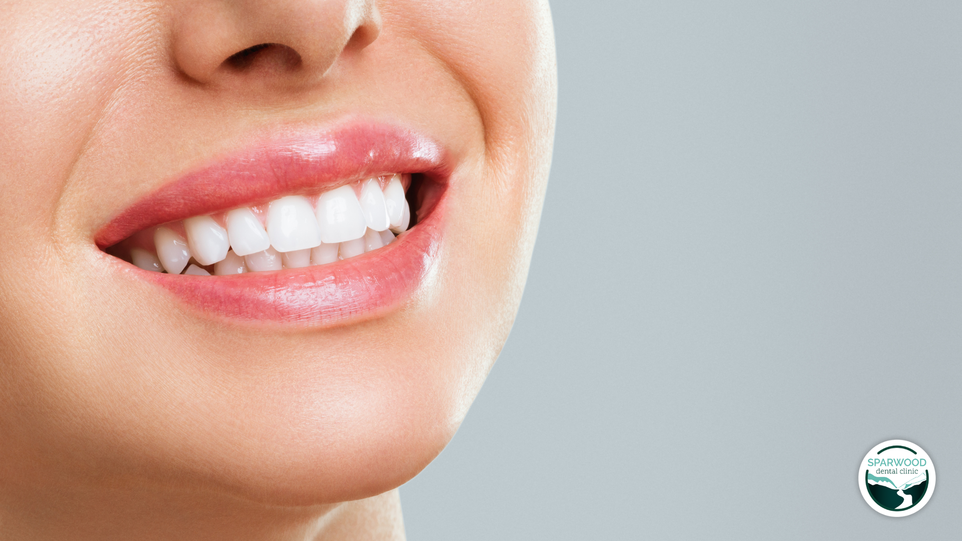 Close-up of a woman's smiling mouth, showing bright white teeth and full pink lips against a gray background.