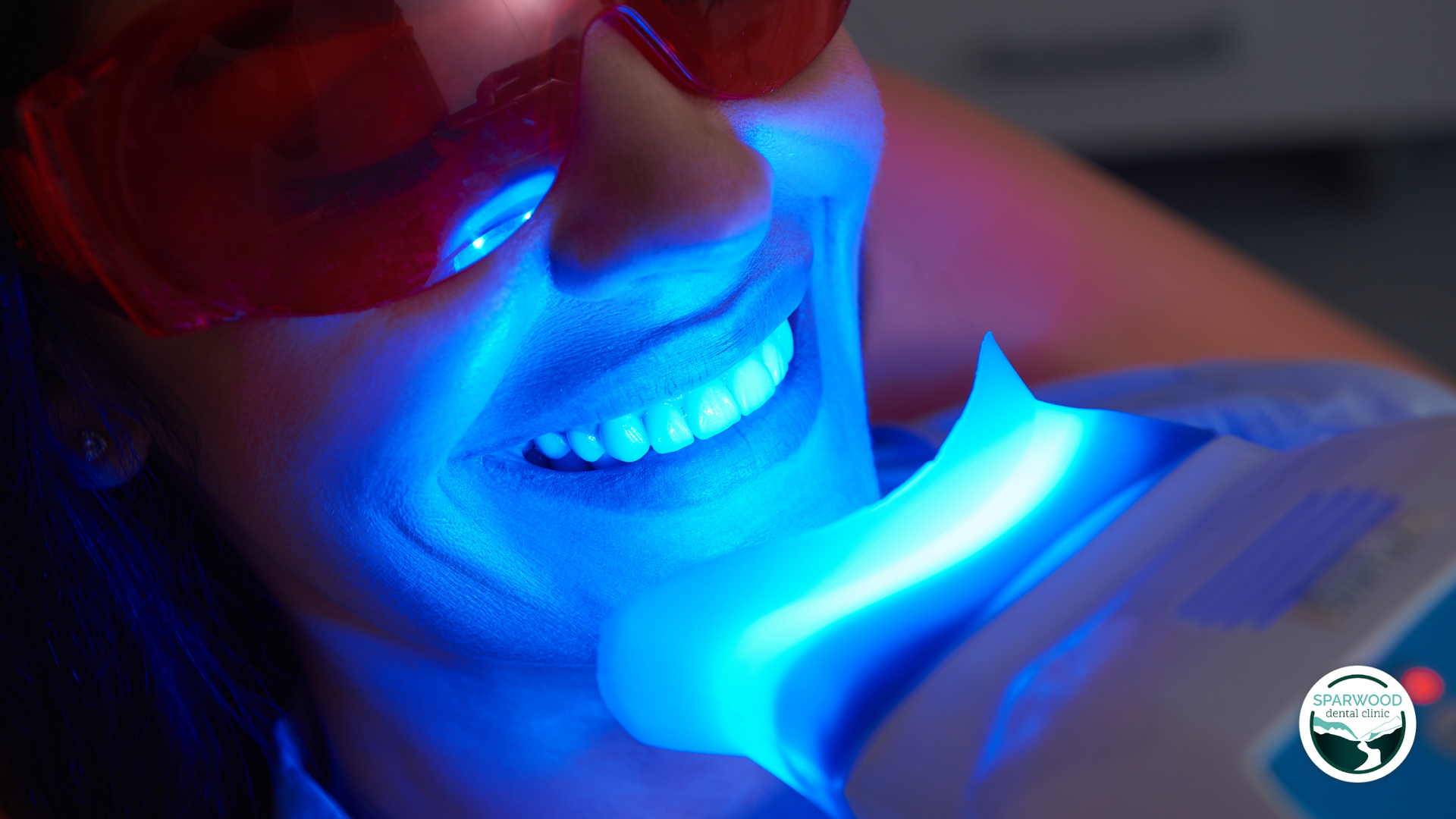 Woman undergoing teeth whitening procedure with blue light. She wears protective glasses.